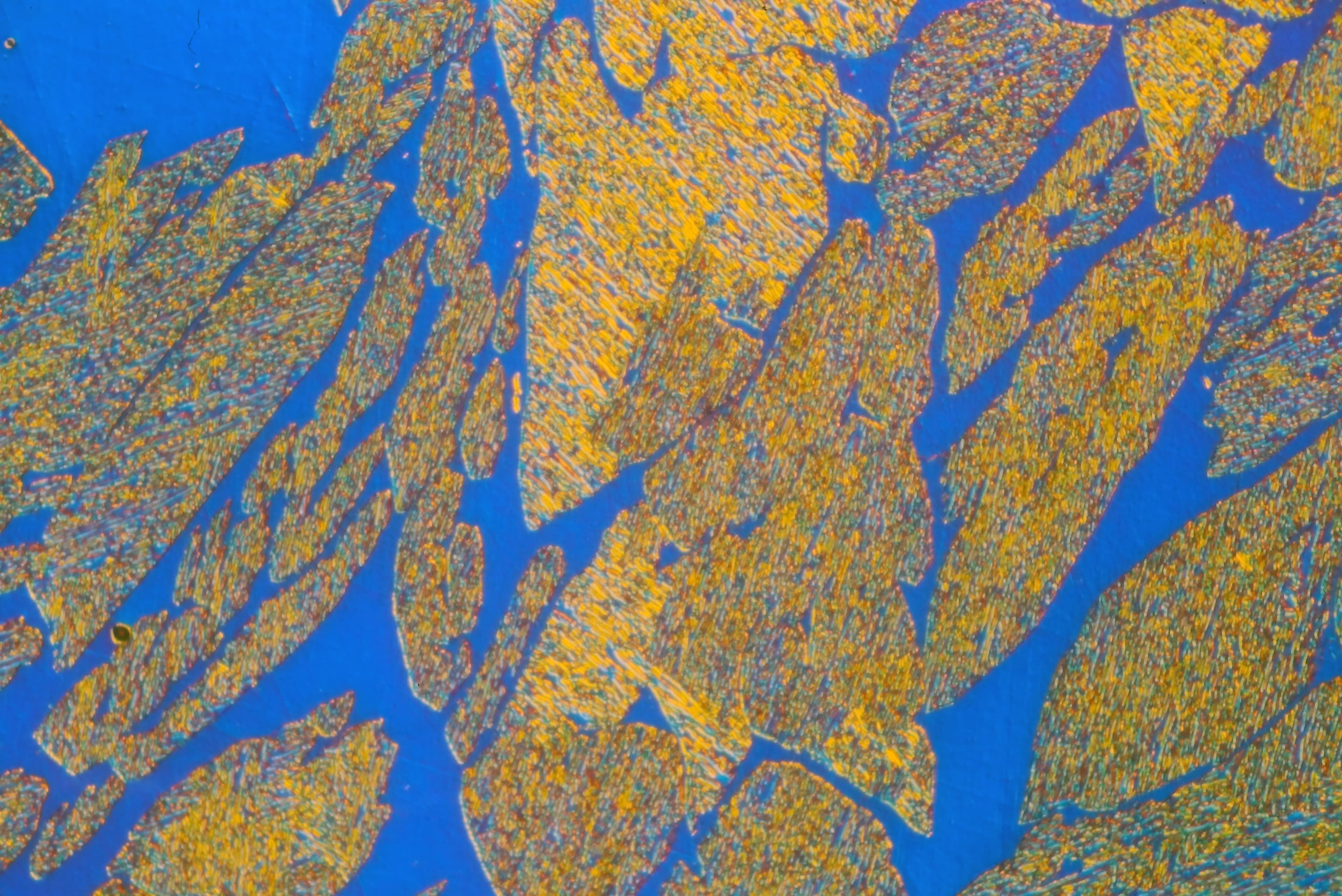 stainless steel, etched with Kallings no. 2, 400X, DIC