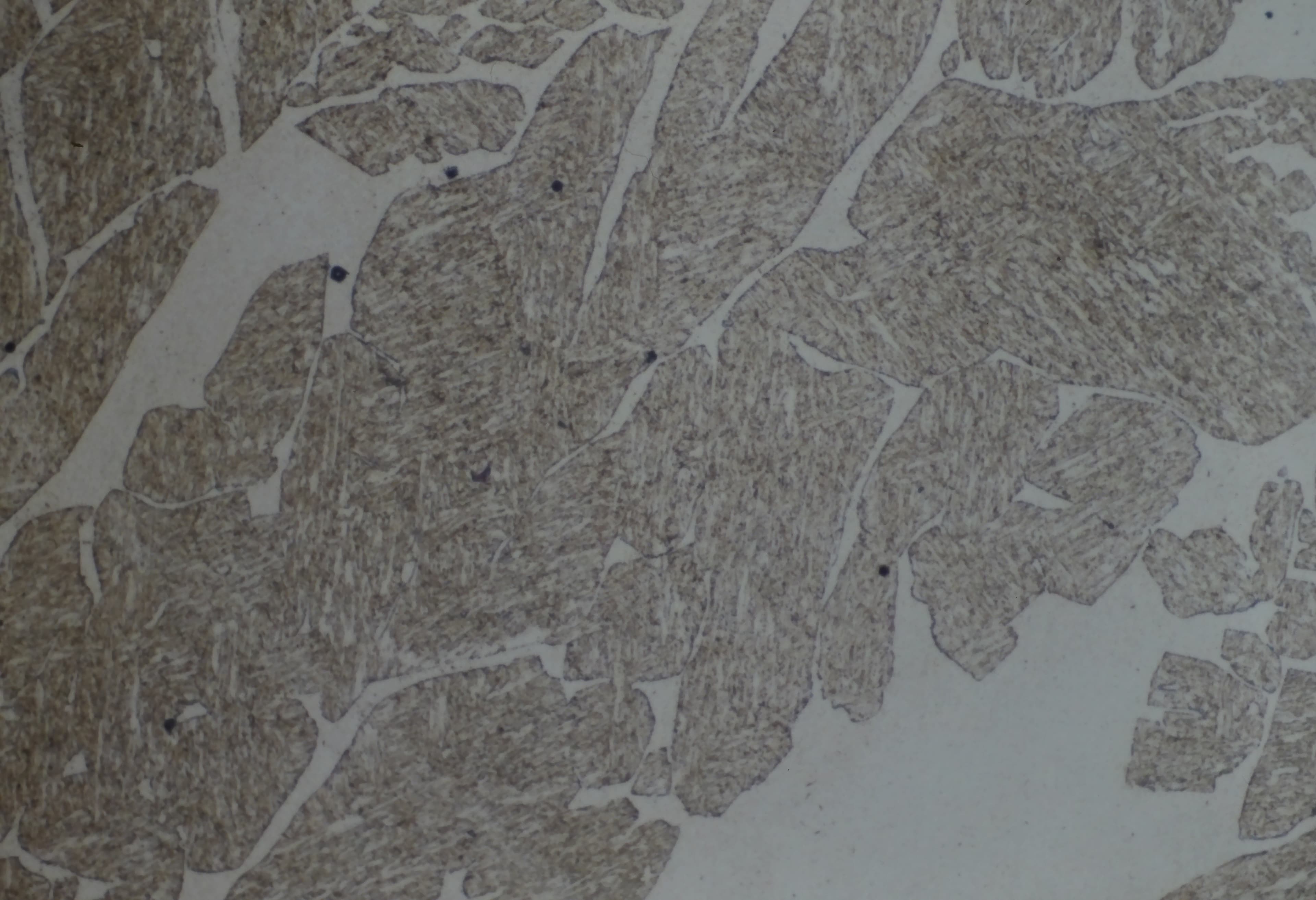 431 stainless steel microstructure at 400X magnification showing grain structure after metallographic sample preparation with Kallings no. 2 etchant