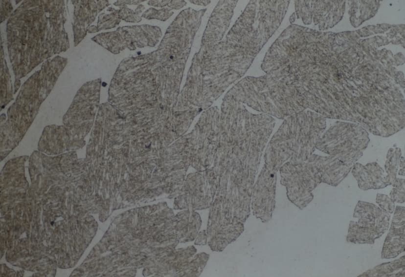 Stainless steel microstructure