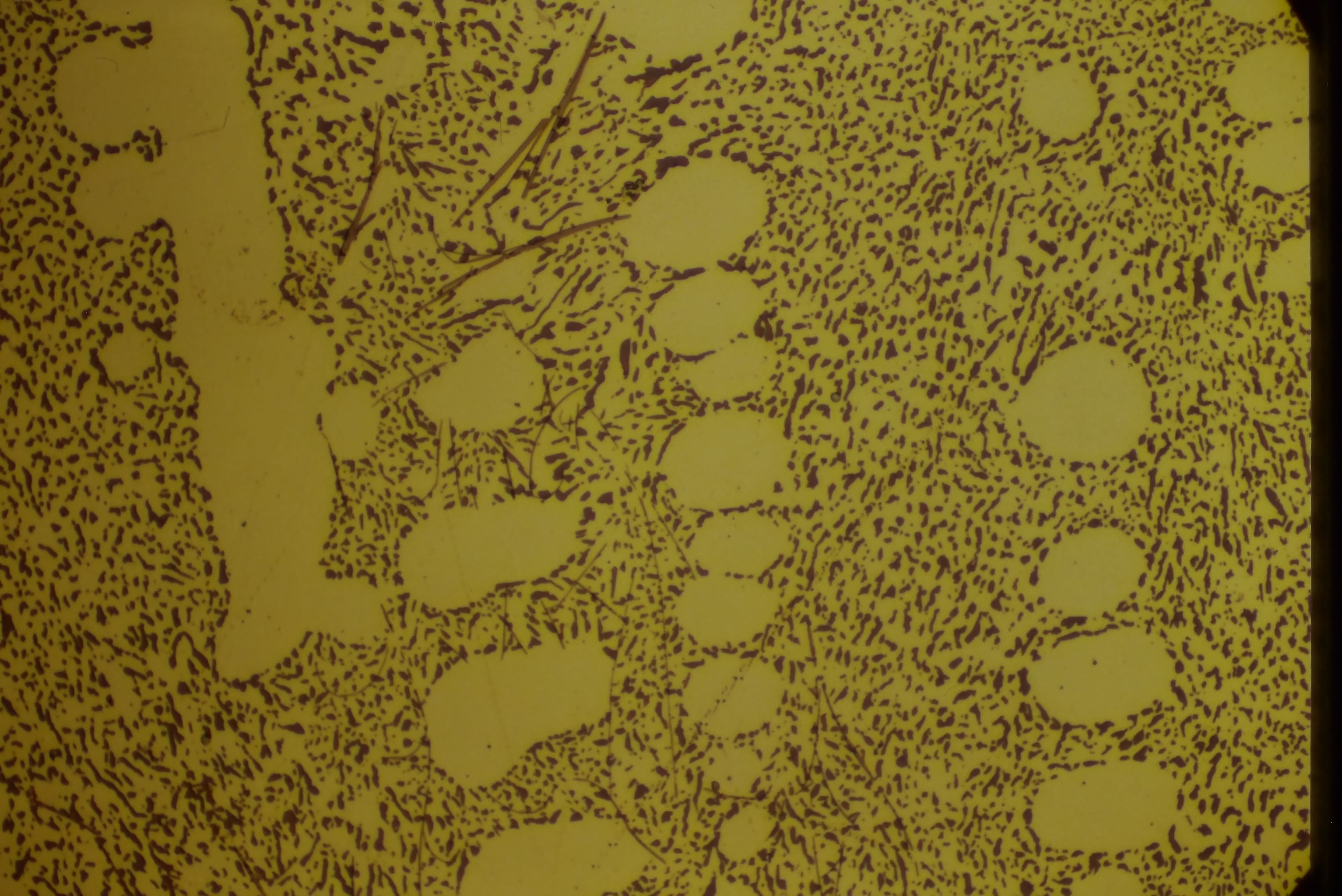 Aluminum, etched with Kellers, 400X