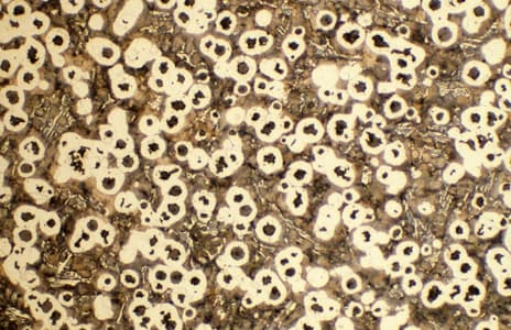 Nodular cast iron after etching, showing graphite nodules with ferrite halos in a pearlitic matrix